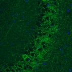 Immunohistochemical staining of mouse hippocampal formation shows strong positivity in GABAergic fibers.