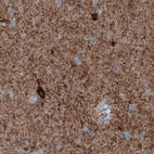 Immunohistochemical staining of human cerebral cortex shows immunoreactivity in neuropil and some neuronal cell bodies.