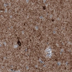 Immunohistochemical staining of human cerebral cortex shows immunoreactivity in neuropil and some neuronal cell bodies.