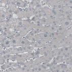 Immunohistochemical staining of human liver shows absence of immunoreactivity (negative control).