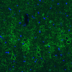 Immunohistochemical staining of mouse cerebral cortex shows strong immunoreactivity in GABAergic synapses on pyramidal neurons.
