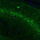 Immunofluorescence staining of mouse brain shows moderate to strong positivity in the GABAergic neural fibers and neurons in the hippocampus.