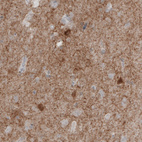 Anti-GAD1 Antibody