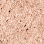 Immunohistochemical staining of human cerebral cortex shows strong positivity in the GABAergic neurons and fibers.