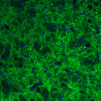 Immunohistochemical staining of rat substantia nigra shows strong immunoreactivity in GABAergic fibers.