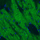 Immunohistochemical staining of mouse globus pallidus shows strong positivity in GABAergic fibers.