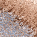 Immunohistochemical staining of human cerebellum shows strong cytoplasmic positivity in Purkinje cells.