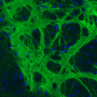 Immunohistochemical staining of rat globus pallidus shows strong positivity in GABAergic fibers.