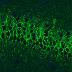 Immunohistochemical staining of rat hippocampal formation shows strong positivity in GABAergic fibers in the CA1 area.