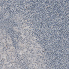 Immunohistochemical staining of human tonsil shows absence of immunoreactivity (negative control).