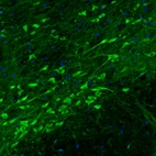 Immunofluorescence staining of rat substantia nigra shows strong positivity in dopamine neurons in pars compacta.