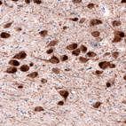 Immunohistochemical staining of human substantia nigra shows cytoplasmic positivity in dopamine neurons in pars compacta.