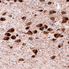 Anti-DDC Antibody