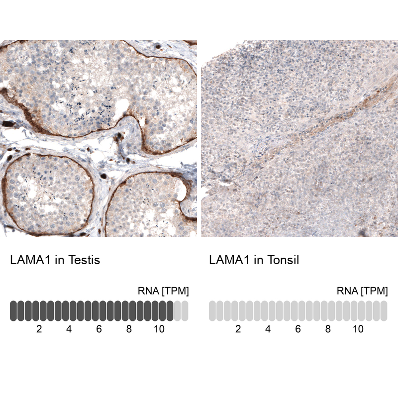 Anti-LAMA1 Antibody