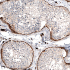 Anti-LAMA1 Antibody