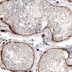 Immunohistochemical staining of human testis shows strong positivity in basement membrane in seminiferous ducts.