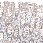 Immunohistochemical staining of human gastrointestinal shows no positivity in basement membrane of glandular cells as expected.