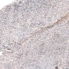 Immunohistochemical staining of human tonsil shows no positivity in lymphoid cells as expected.