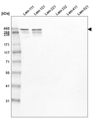 Western blot analysis of purified human recombinant Laminin-111, Laminin-121, Laminin-221, Laminin-332, Laminin-411 and Laminin-521.