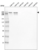 Western blot analysis of purified human recombinant Laminin-111, Laminin-121, Laminin-221, Laminin-332, Laminin-411 and Laminin-521.