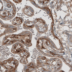 Anti-LAMB1 Antibody