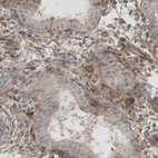 Anti-LAMB1 Antibody