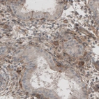 Immunohistochemical staining of human endometrium shows immunoreactivity in basement membrane of glandular epithelium.