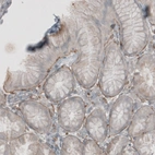 Immunohistochemical staining of human stomach shows positivity in basement membrane of glandular epithelium.