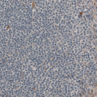 Immunohistochemical staining of human lymph node shows absence of immunoreactivity in lymphoid cells (negative control).