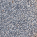 Immunohistochemical staining of human lymph node shows absence of immunoreactivity in lymphoid cells (negative control).