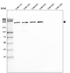 Western blot analysis of purified human recombinant Laminin-111, Laminin-211, Laminin-411, Laminin-511, Laminin-521 and Laminin-332.