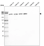 Western blot analysis of purified human recombinant Laminin-111, Laminin-211, Laminin-411, Laminin-511, Laminin-521 and Laminin-332.