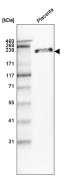 Western blot analysis in human placenta tissue.