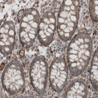 Immunohistochemical staining of human colon shows strong positivity in basement membrane of glandular epithelium.