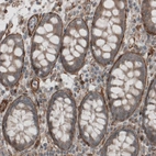 Immunohistochemical staining of human colon shows strong positivity in basement membrane of glandular epithelium.