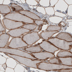 Immunohistochemical staining of human skeletal muscle shows strong membranous immunoreactivity in myocytes.