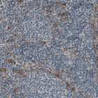 Immunohistochemical staining of human lymph node shows absence of immunoreactivity in lymphoid cells (negative control).