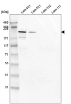 Western blot analysis of purified human recombinant Laminin-421, Laminin-521, Laminin-332 and Laminin-111.