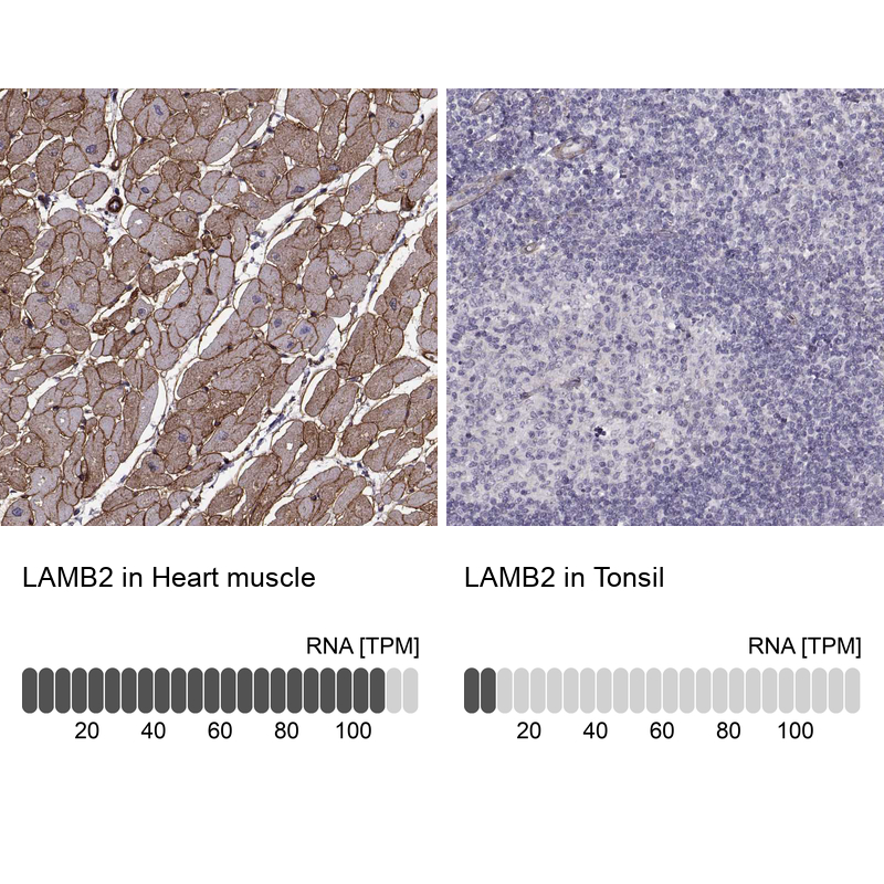 Anti-LAMB2 Antibody