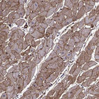 Immunohistochemical staining of human heart muscle shows moderate membranous positivity in cardiomyocytes.