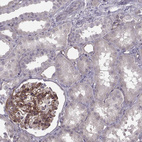 Immunohistochemical staining of human kidney shows moderate membranous positivity in basement membrane of cells in glomeruli.