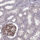 Immunohistochemical staining of human kidney shows moderate membranous positivity in basement membrane of cells in glomeruli.