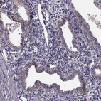 Immunohistochemical staining of human endometrium shows moderate positivity in basement membrane of glandular cells.