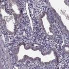 Immunohistochemical staining of human endometrium shows moderate positivity in basement membrane of glandular cells.