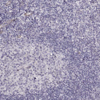Immunohistochemical staining of human tonsil shows no positivity in lymphoid cells as expected.