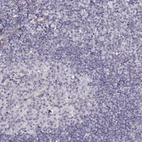Immunohistochemical staining of human tonsil shows no positivity in lymphoid cells as expected.