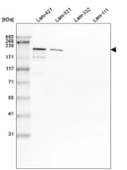 Western blot analysis of purified human recombinant Laminin-421, Laminin-521, Laminin-332 and Laminin-111.