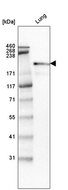 Western blot analysis in human lung tissue.
