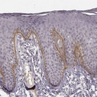 Immunohistochemical staining of human skin shows moderate positivity in basement membrane of epidermis.