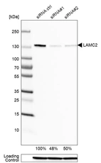 Western blot analysis in A-431 cells transfected with control siRNA, target specific siRNA probe #1 and #2, using Anti-LAMC2 antibody. Remaining relative intensity is presented. Loading control: Anti-GAPDH.